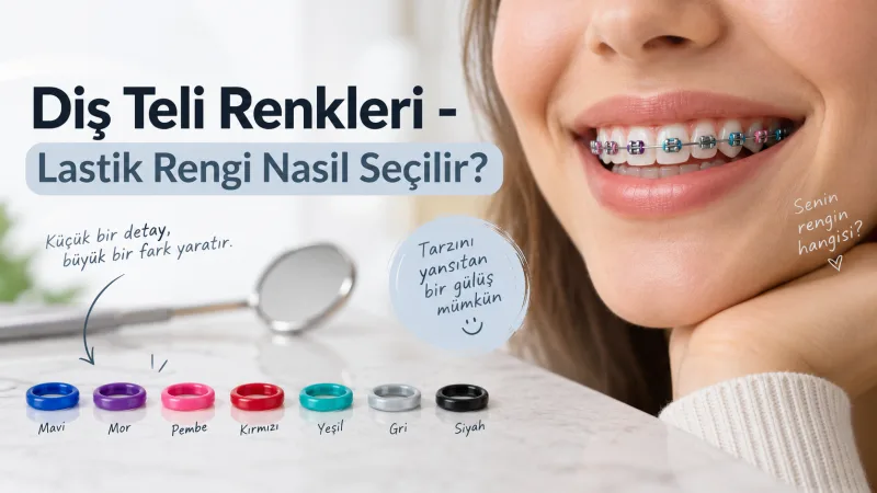 Diş Teli Renkleri - Lastik Rengi Nasıl Seçilir?